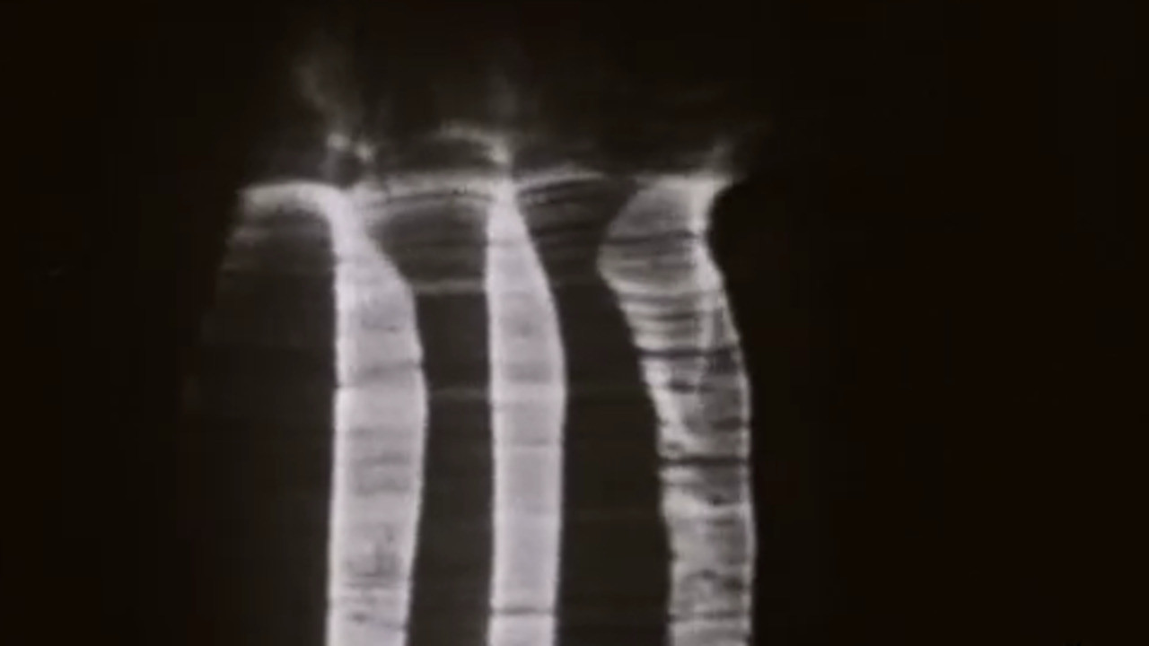 The Achalunés backdrop