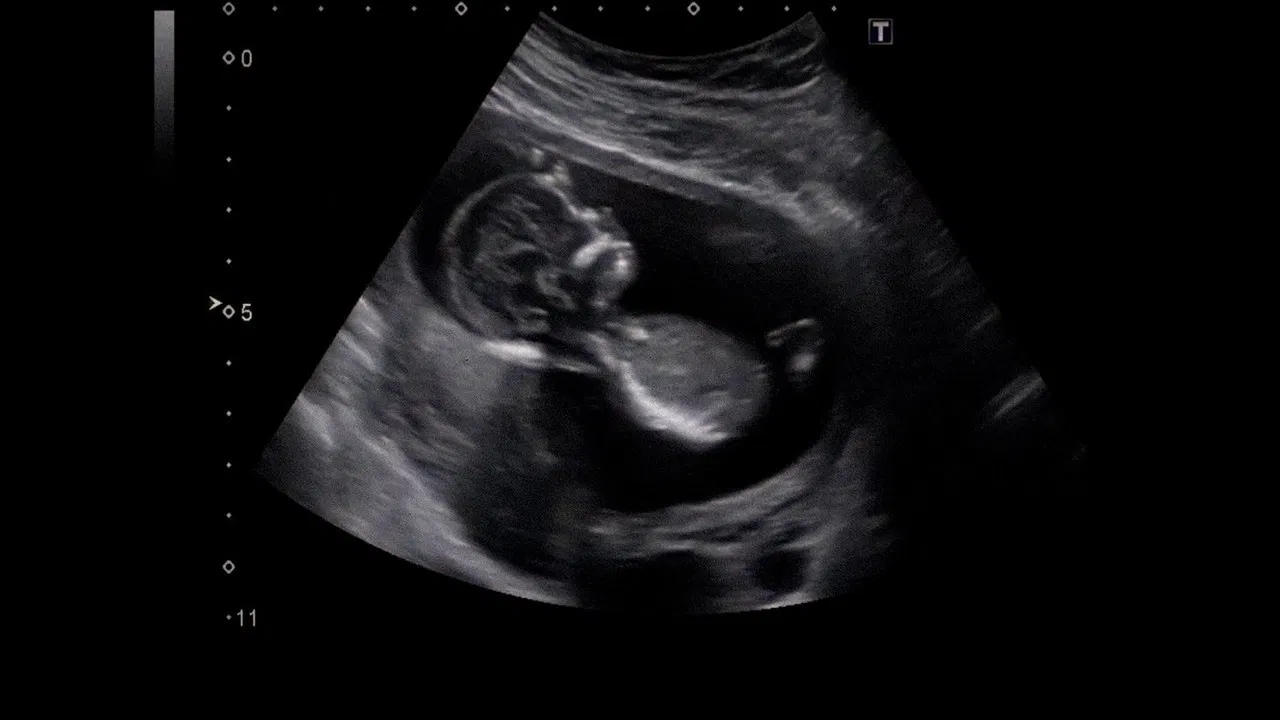 Foreign Bodies backdrop