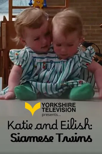 Katie and Eilish: Siamese Twins poster