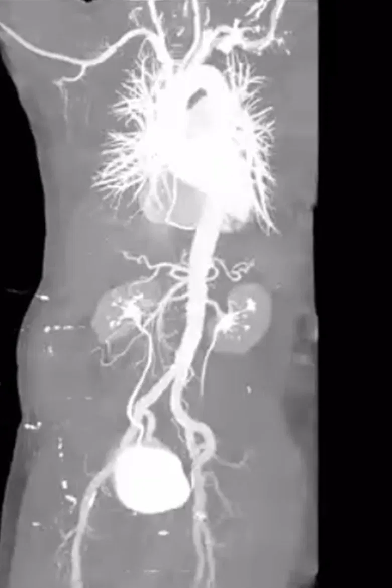 X-Ray Eros poster background