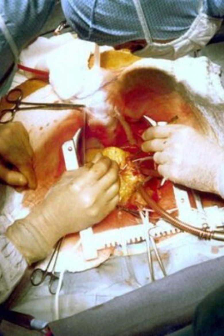 "The Heart" 40 Years Later poster background